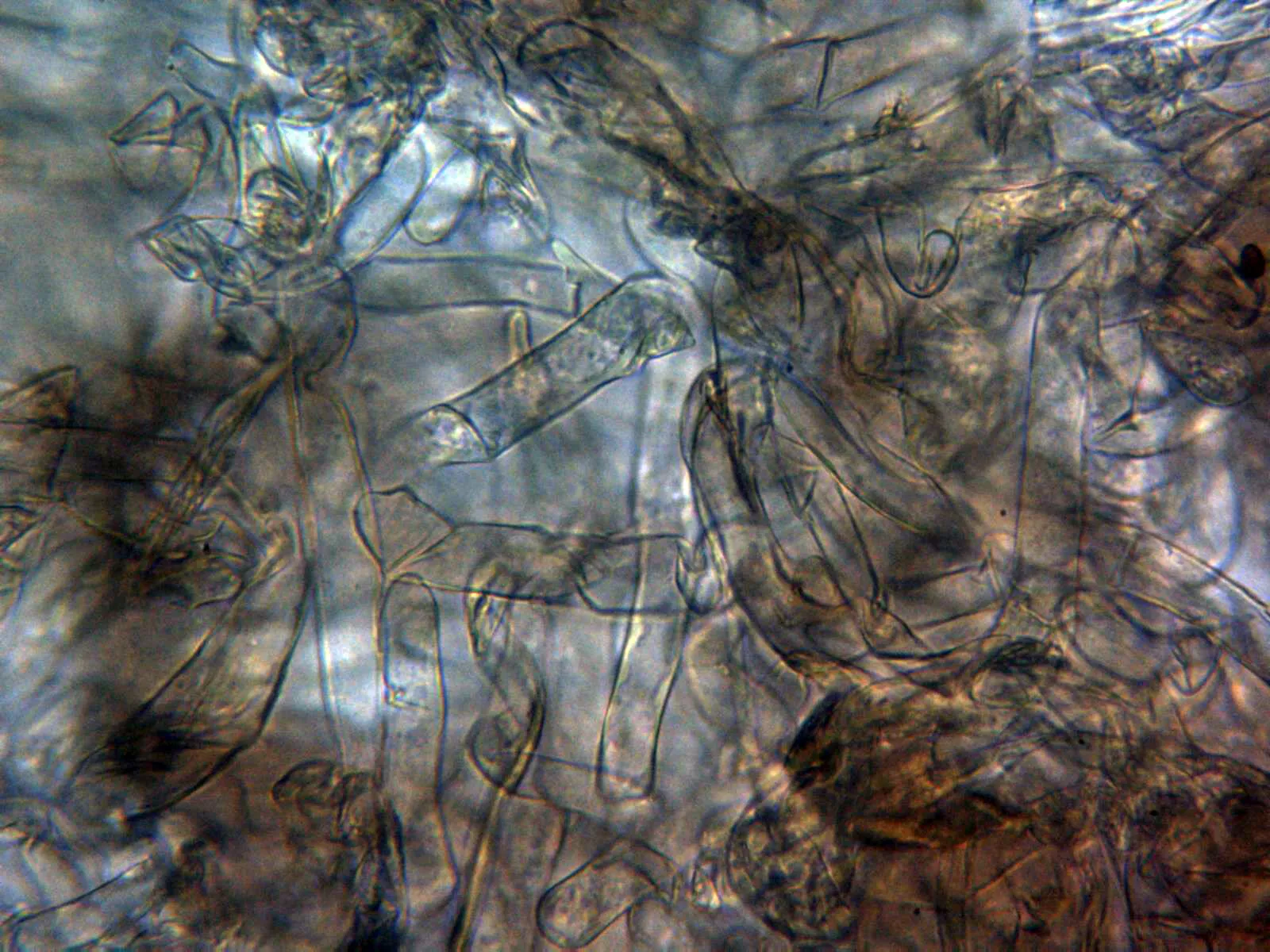 Microscopía de Macrolepiota procera - 11 - Cutícula agua x 400